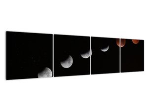 Vászonkép